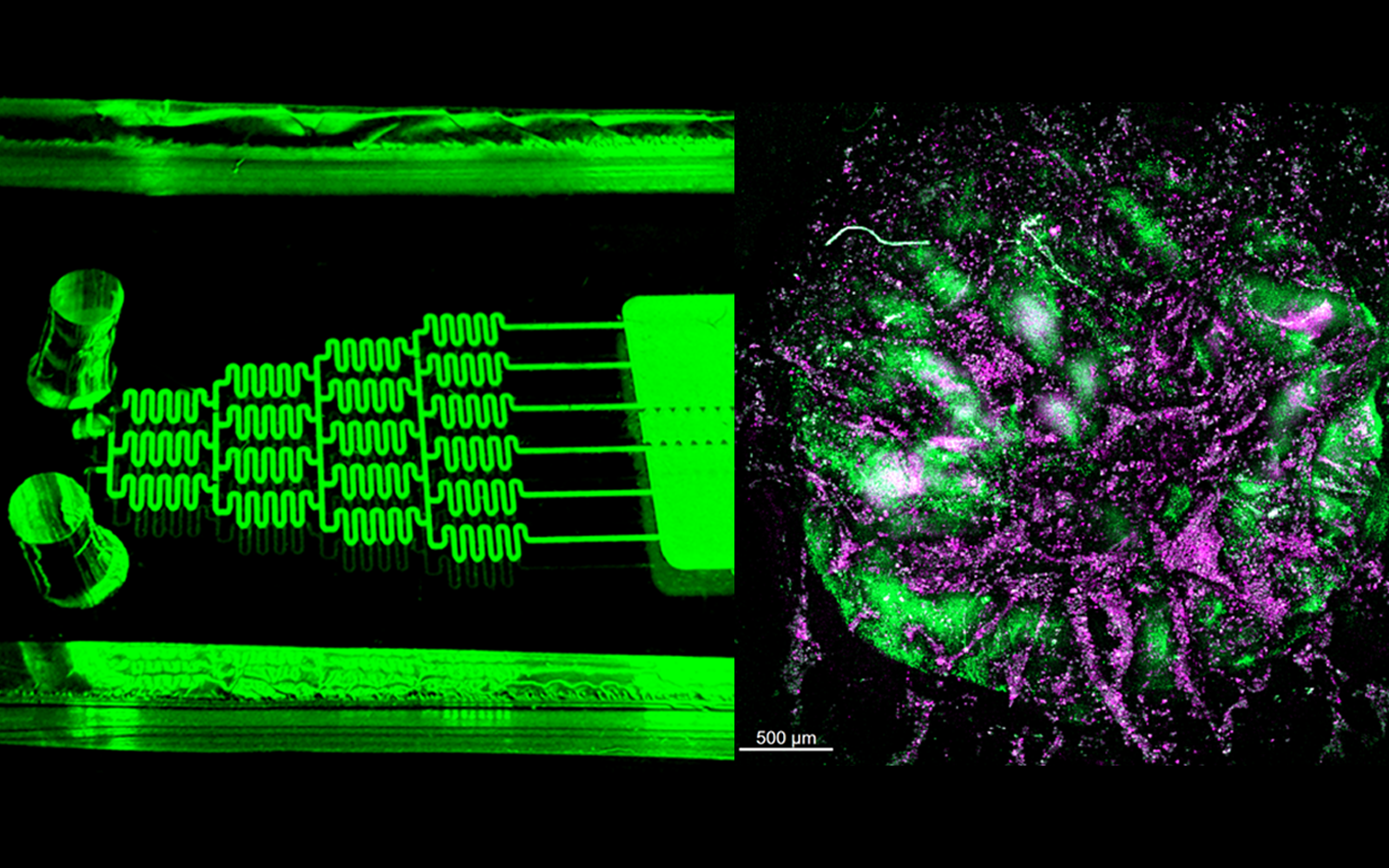 The left image shows the immune organ-on-chip, where the organoids (right) are grown to study the response of human donors. The right image shows development of types of immune cells relevant to the antibody response. 